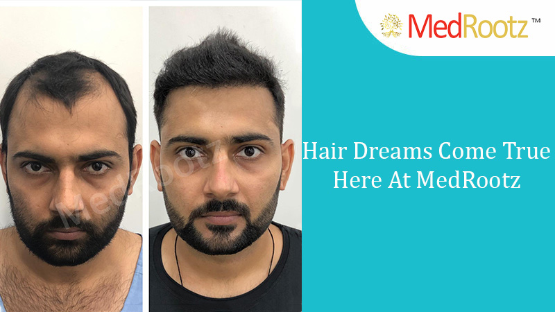 Hair Dreams Come True Here At MedRootz