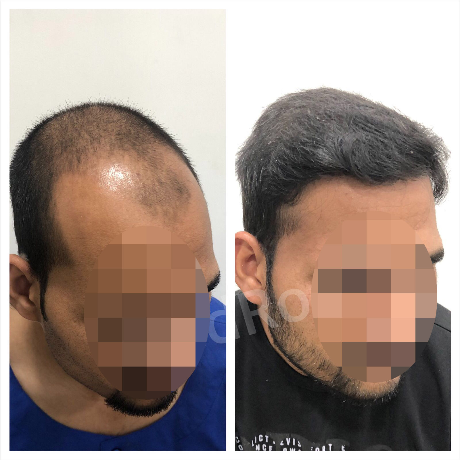 Real Results