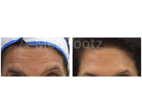 Anti Aging Clinic in India