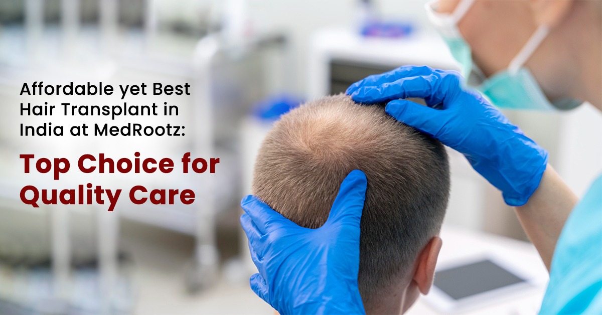 Best Hair Transplant in India