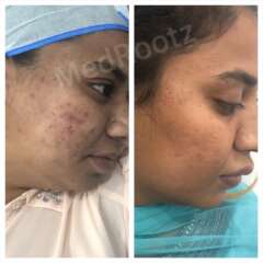 skin treatment new delhi