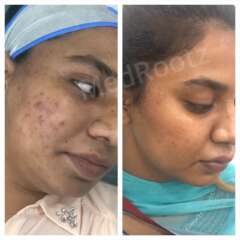 skin treatment center in delhi