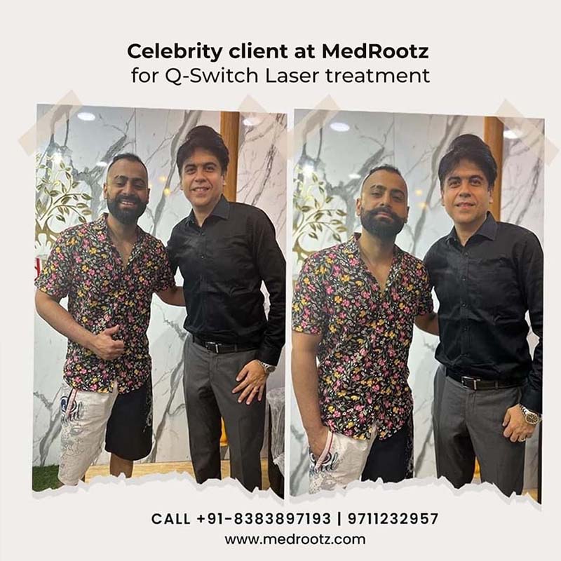 Best Hair clinic in delhi